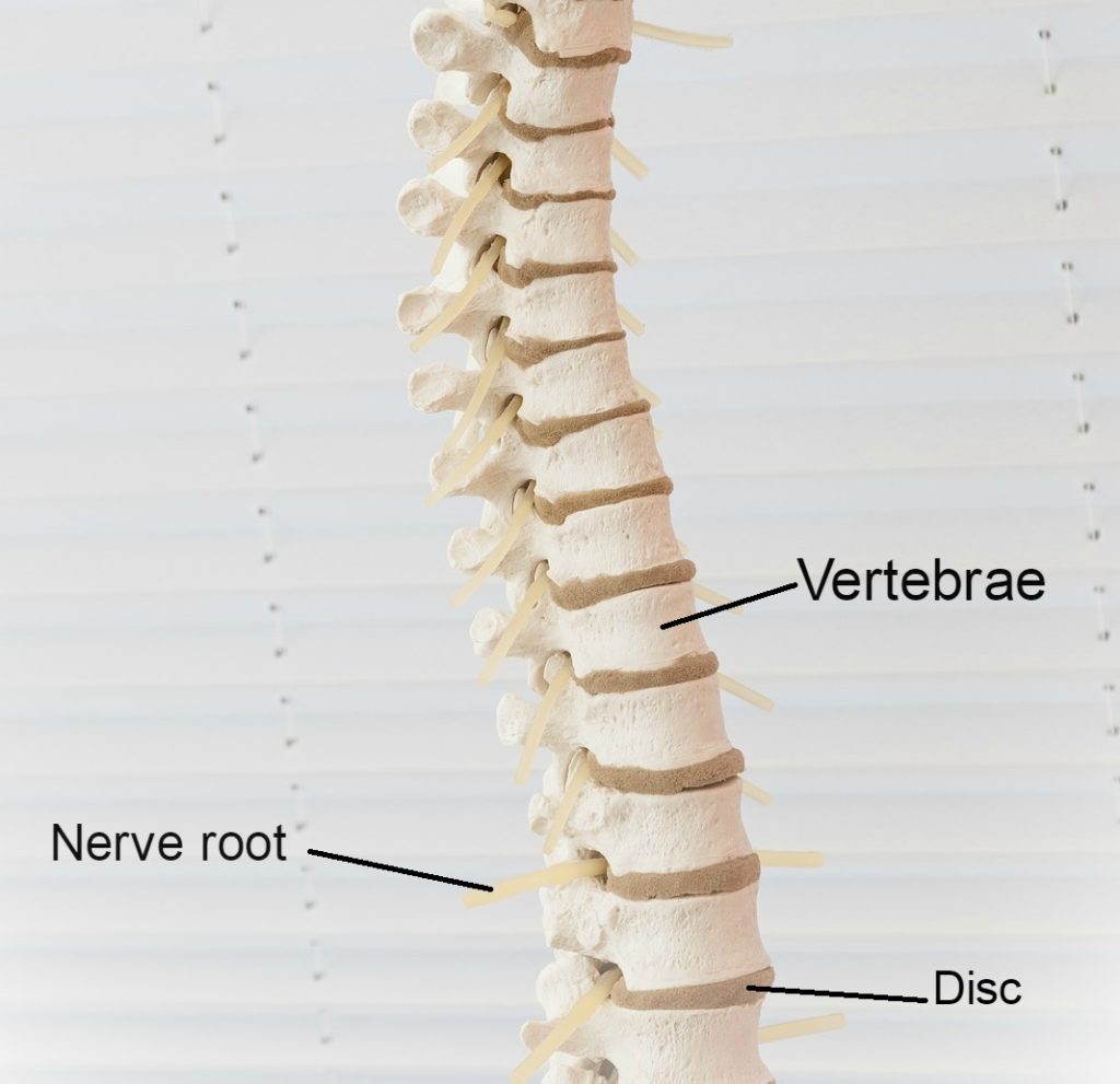 image of the spine in spinal stenosis