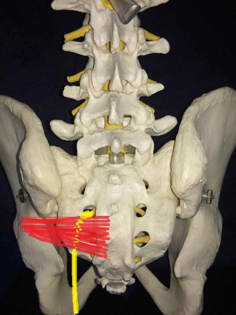 piriformis muscle and the sciatic nerve running through it