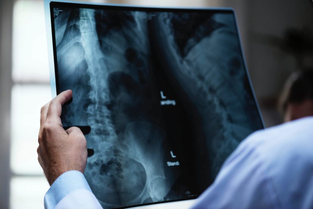 Sciatica symptoms cannot be seen on x-ray