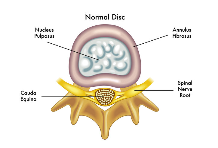 images of a normal lumbar spine disc
