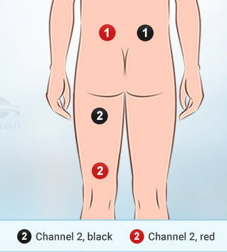 Use a tens machine for sciatica pain relief by following the placement of the pads here