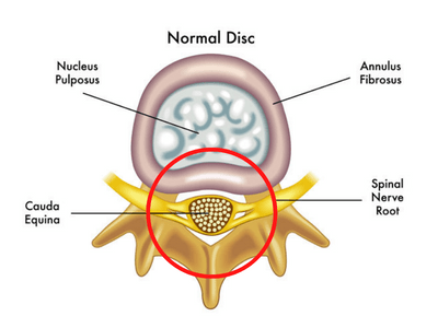area of the spine affected by spinal stenosis